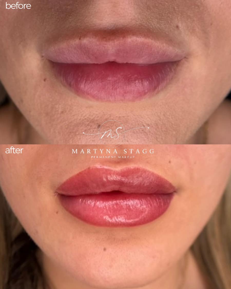 Labios antes y después del lip blush